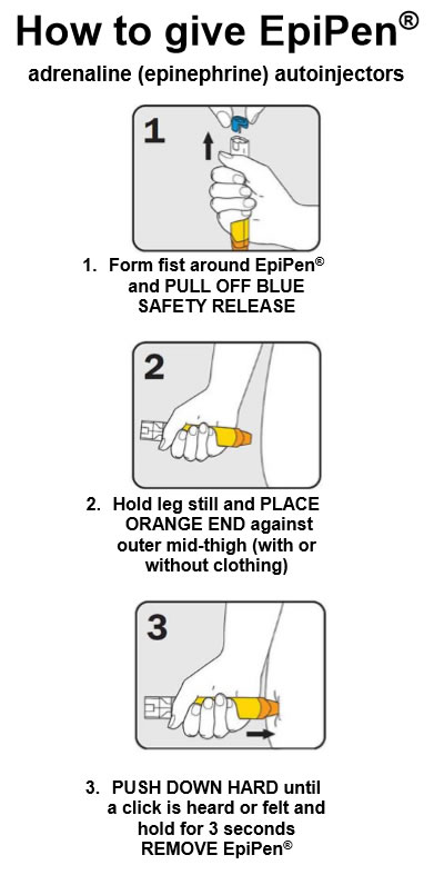 What To Do In The Case Of Anaphylaxis Severe Allergic Reaction What To Do In The Case Of Anaphylaxis Severe Allergic Reaction
